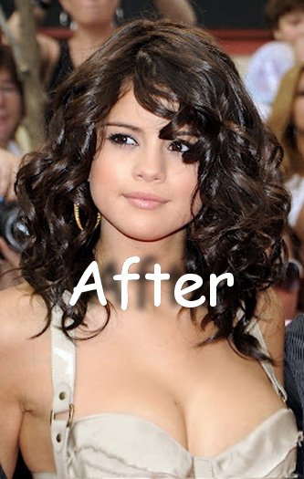 selena gomez after breast impplant surgery